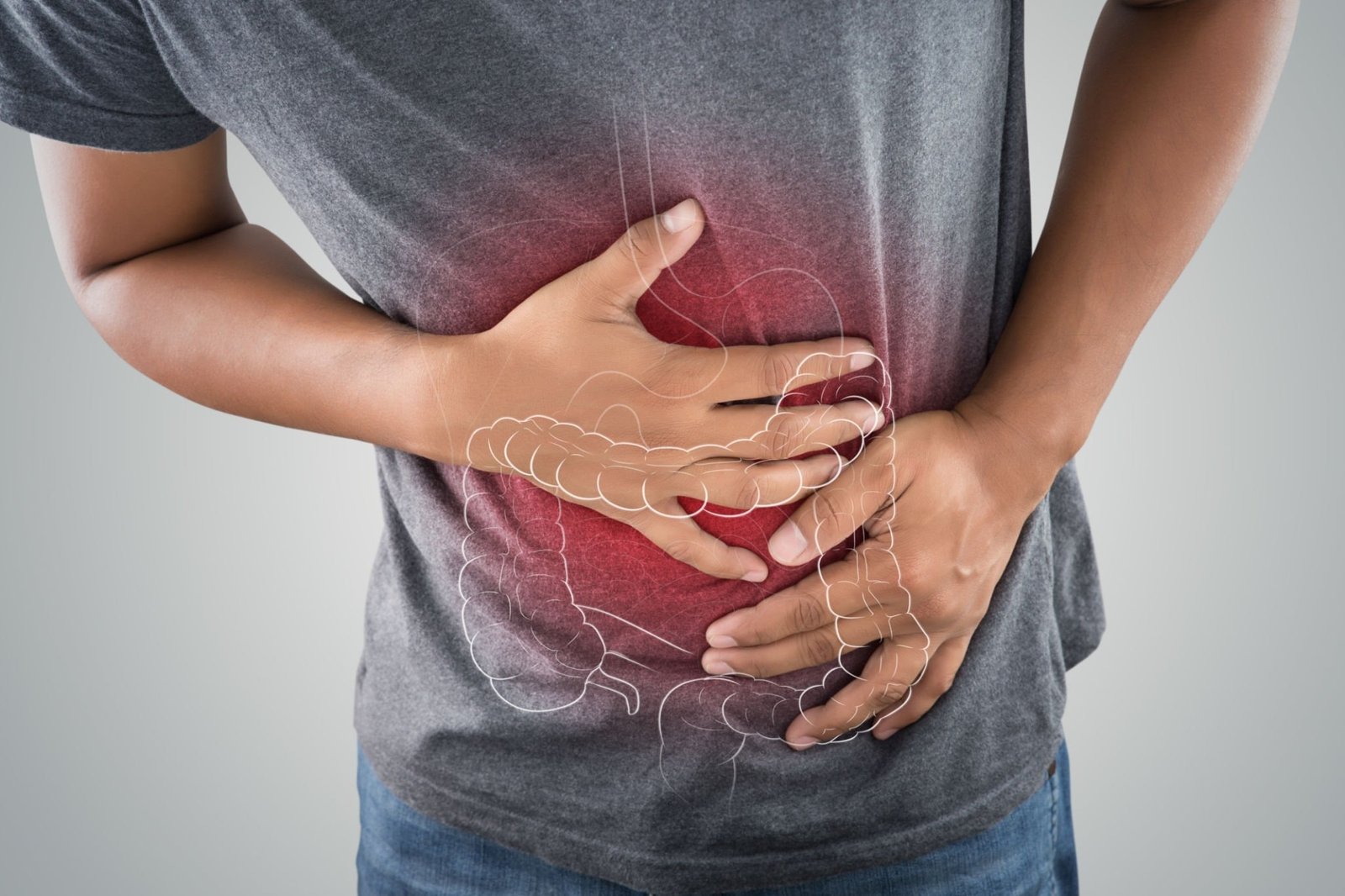 Bowel Cancer 
